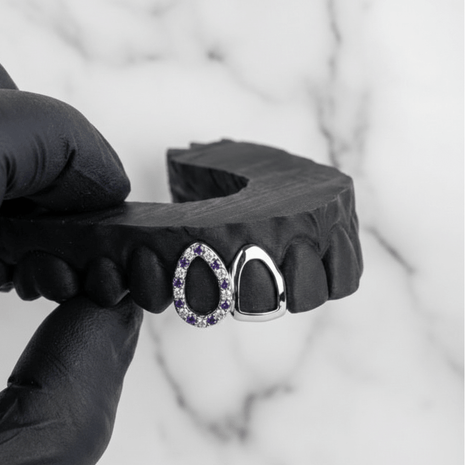 TESSER (GOLD GRILLZ) - 10k gold - HC Grillz