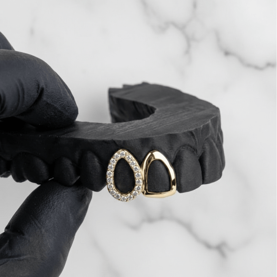 TESSER (GOLD GRILLZ) - 10k gold - HC Grillz