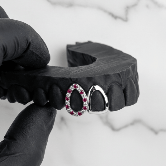 TESSER (GOLD GRILLZ) - 10k gold - HC Grillz