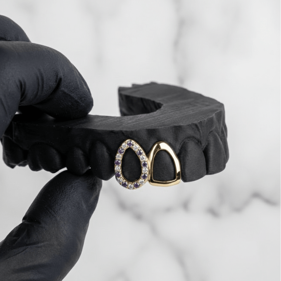 TESSER (GOLD GRILLZ) - 10k gold - HC Grillz