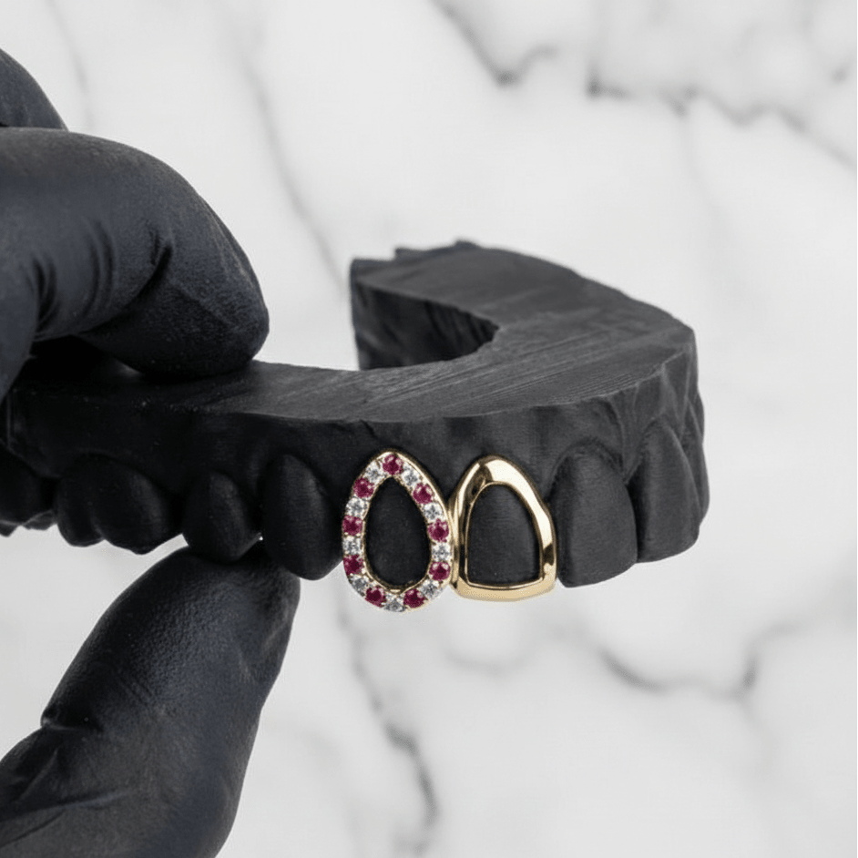 TESSER (GOLD GRILLZ) - 10k gold - HC Grillz