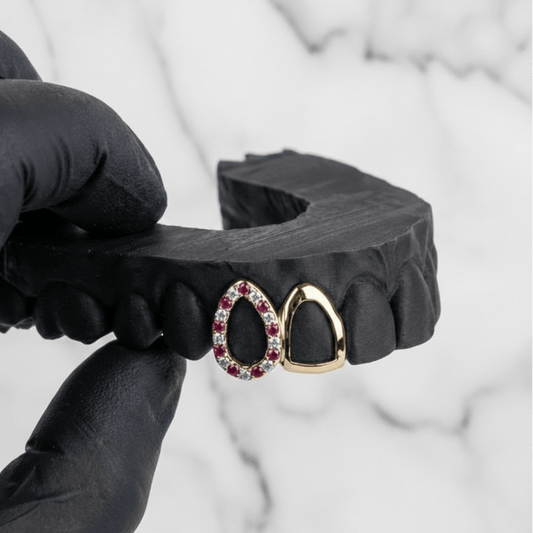 TESSER (GOLD GRILLZ) - 10k gold - HC Grillz