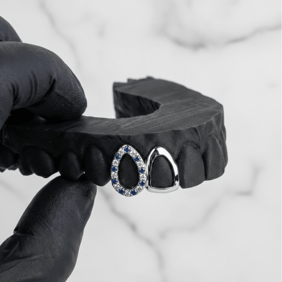 TESSER (GOLD GRILLZ) - 10k gold - HC Grillz