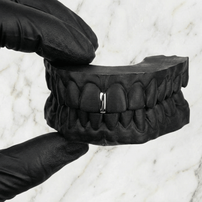 VANTA (GOLD GAP GRILLZ) - 10k gold - HC Grillz