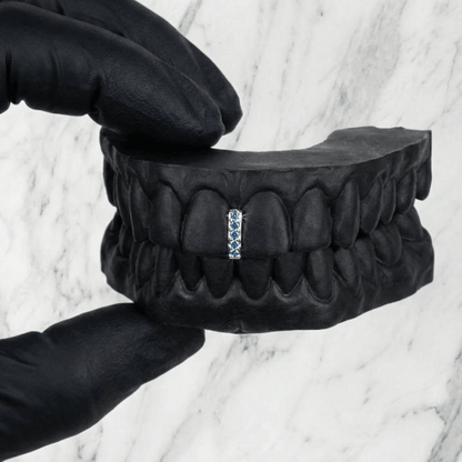 VANTA (GOLD GAP GRILLZ) - 10k gold - HC Grillz