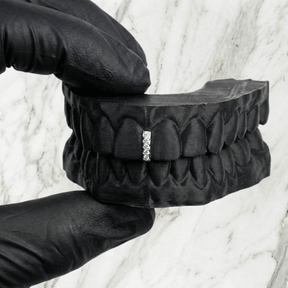 VANTA (GOLD PLATED GAP GRILLZ) - White - HC Grillz