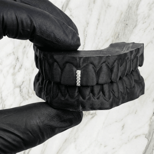 VANTA (GOLD PLATED GAP GRILLZ) - White - HC Grillz